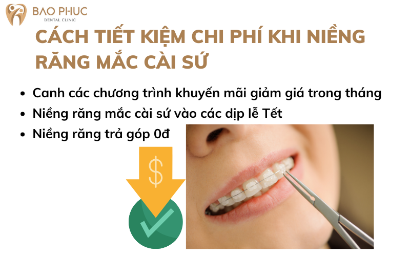 Cách tiết kiệm chi phí khi niềng răng mắc cài sứ