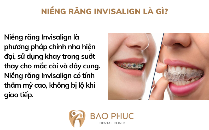 Niềng răng Invisalign là gì? Có gì khác với niềng răng truyền thống?
